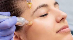 Dermapen Nedir Ne İşe Yarar | Dermapen Faydaları Nedir Nasıl Yapılır?